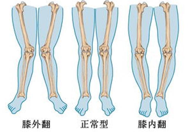 宝宝常见的"软萌"坐姿,却影响自身的骨骼发育?现在纠正不算晚
