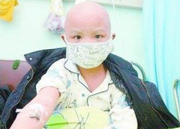 儿童"白血病"早期,身体会发出3"警报",家长要当心了!