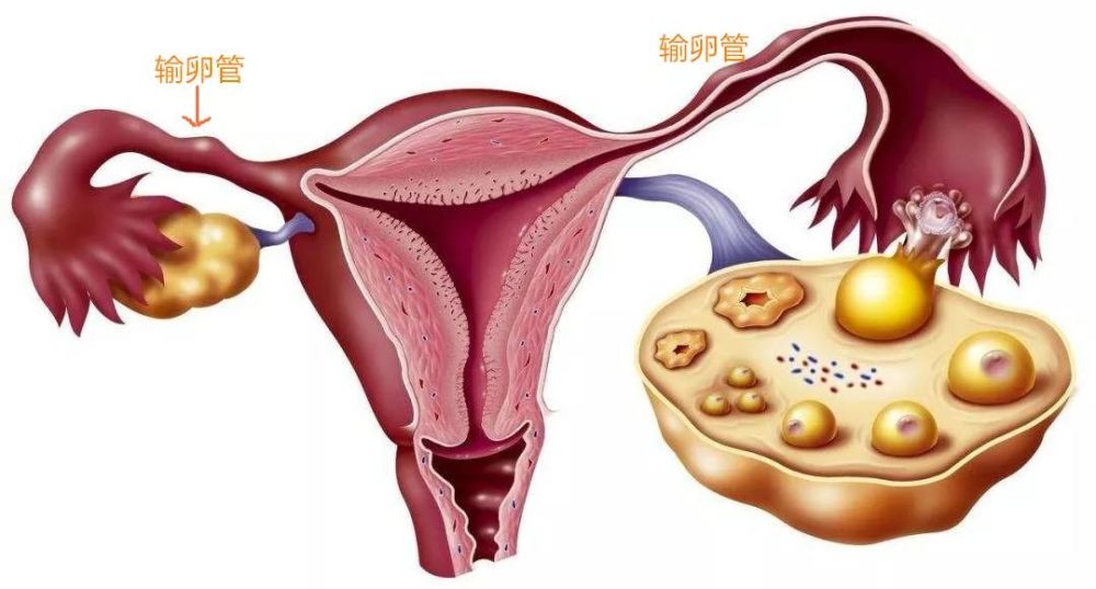 输卵管,卵子,子宫,四维彩超