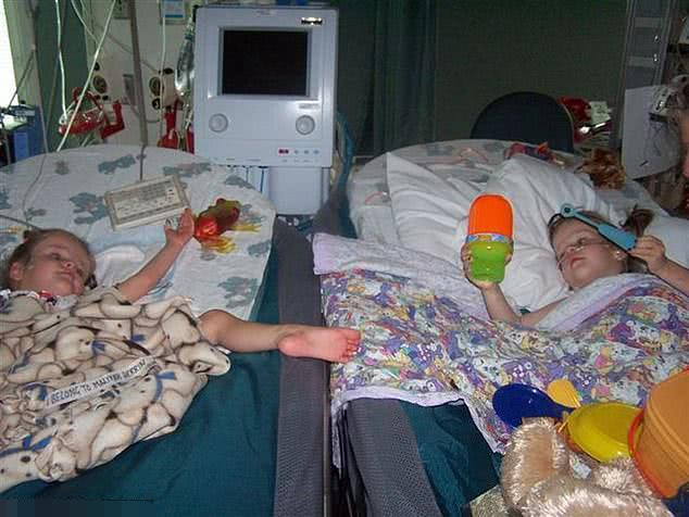 13年前连体双胞胎手术分离,如今两人幸福享受高中生活