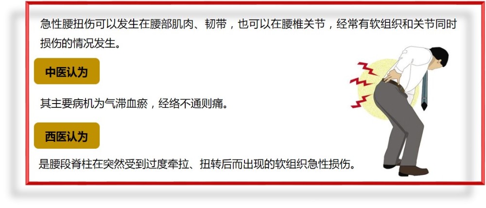 急性腰扭伤,中医疗法了解下