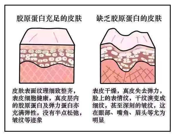 胶原蛋白为何会流失?