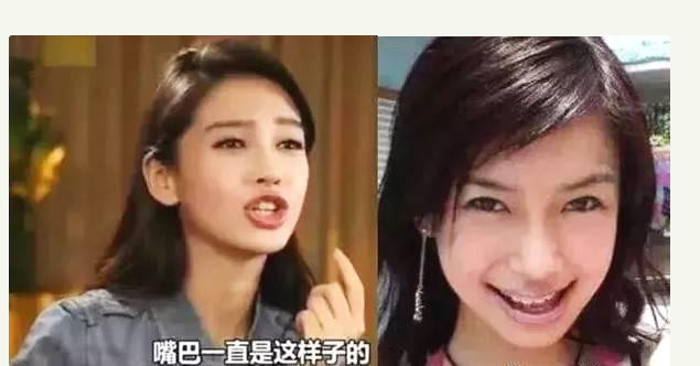 盘点娱乐圈中整牙的女明星,杨颖没了香肠嘴,而最夸张的还是她!
