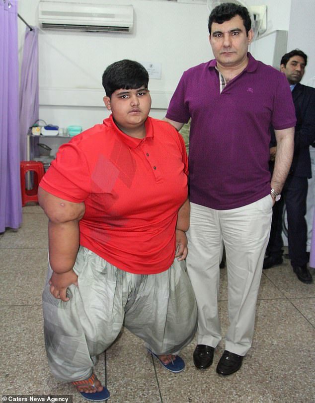 全球最胖男孩:10岁重达394斤,胃口超好,肚子像个无底洞