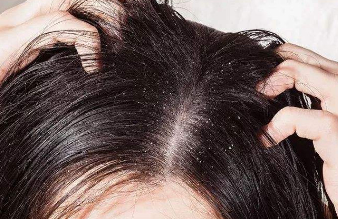女生多久洗一次头最科学?"这个时间"别错过,头发洗完黑又亮!