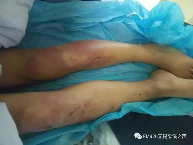 男童被后妈虐打出逃事件 剧情反转后 再反转(图)