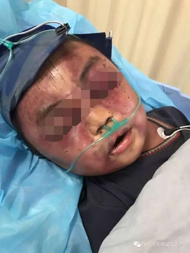 男童被后妈虐打出逃事件 剧情反转后 再反转(图)