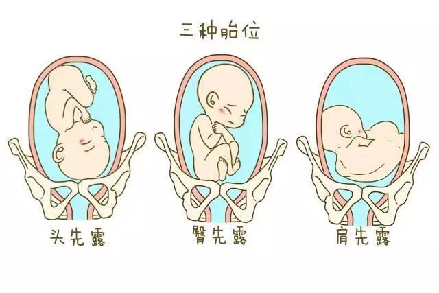 头位是正常胎位,臀位和横位是胎位不正,是异常胎位,后两种胎位,因为