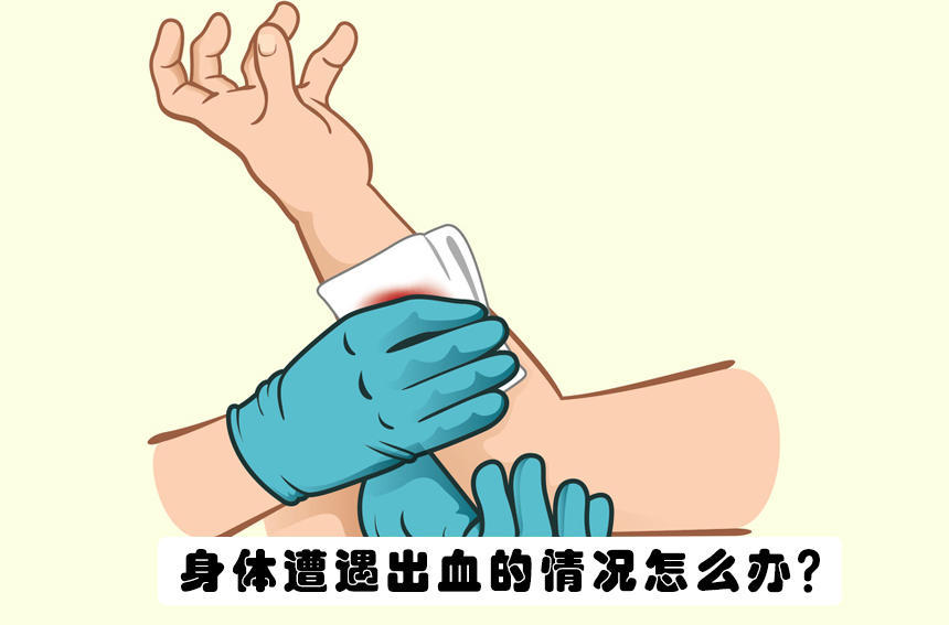 急救,动脉出血,手臂,医生,鼻子
