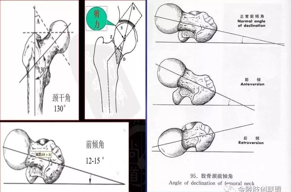 二,股骨颈前倾角