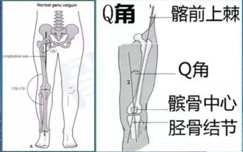 膝外翻角为股骨长轴线与胫骨长轴线在膝关节处相交成向外的夹角.