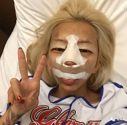 初戀男友劈腿，導(dǎo)致她整形上癮，12年整形無數(shù)次