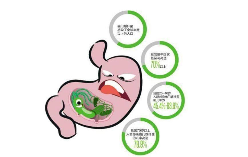 幽门螺杆菌的正常值是多少?医生推荐2种检查法,轻松又