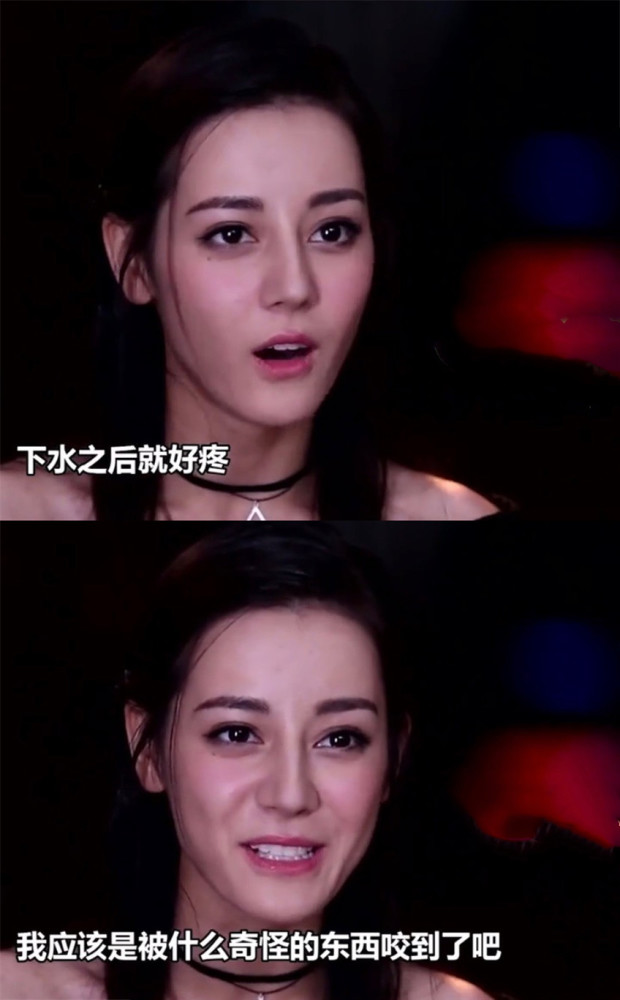 迪丽热巴拍戏受伤,腿上至今有疤痕