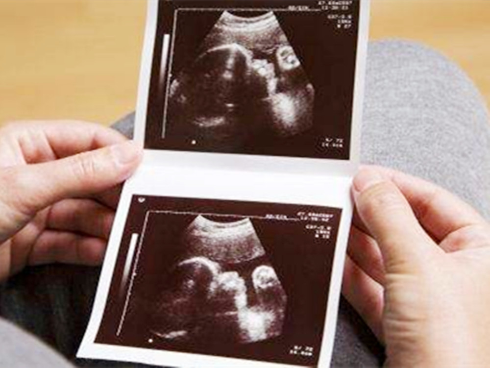 怀孕,四维彩超,孕检,报告单,胎儿发育