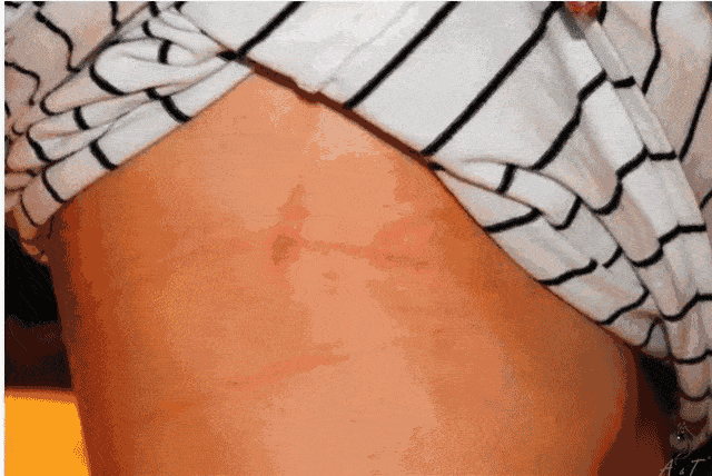 杨幂吊带裙上热搜,却曝光了女性最让人心疼的样子