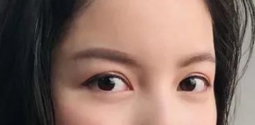 【北京熙仁眼科医院】不同脸型适合的双眼皮形状