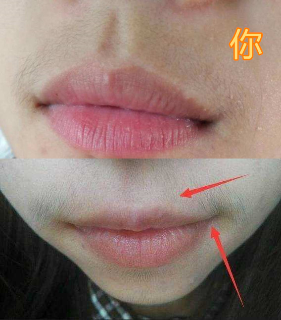 最近"自拍 嘴唇"风很大,男友前任vs你,唇毛忍了,我哭了!