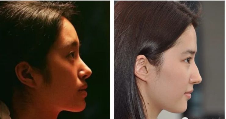 哪个是假象了,比如杨采钰,是不是觉得她侧脸瘪瘪的,有种凸嘴的土气感