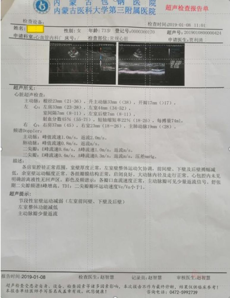 治疗5个月后复查心脏彩超结果