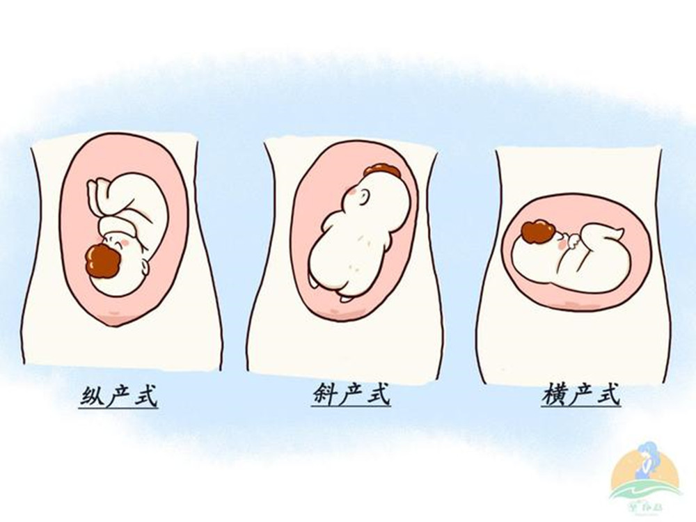 在这三种胎产式当中,横产式是最危险的.