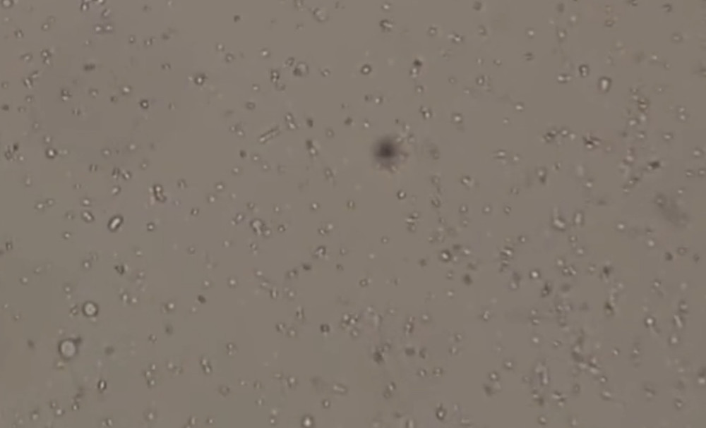 你知道精子是怎么游动的吗?显微镜放大后,网友:它们在