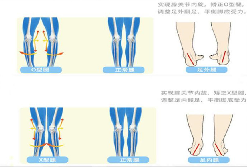 小孩弯腰驼背走路姿势不好看?别以为慢慢长大就会好