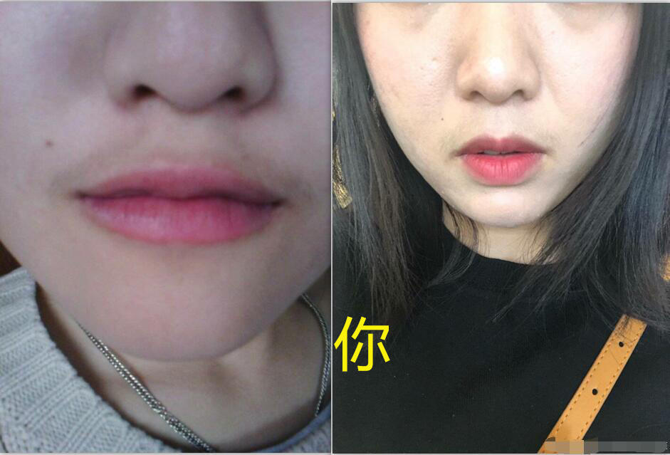 有唇毛的女生更可爱?别人vs你,网友:谁还不是个小仙女