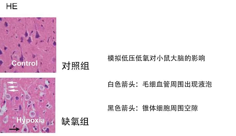 一个对低压缺氧脑组织he染色的显微观察,shao-jun chen等,pnas.