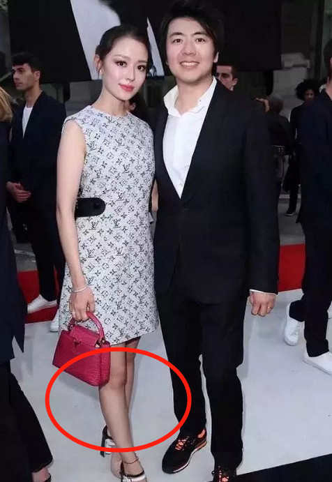 有一种"整容"叫郎朗结婚后,无滤镜下胖成这样,看到老婆沉默了