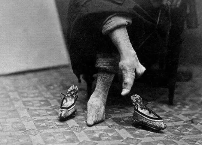 晚清妇女恐怖的畸形小脚,古代女子以"三寸金莲"做为审美标准,真的是太
