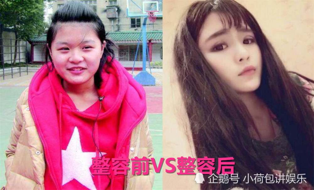 变形计"整容前vs后":韩安冉上瘾,李耐阅变脸,而她堪比