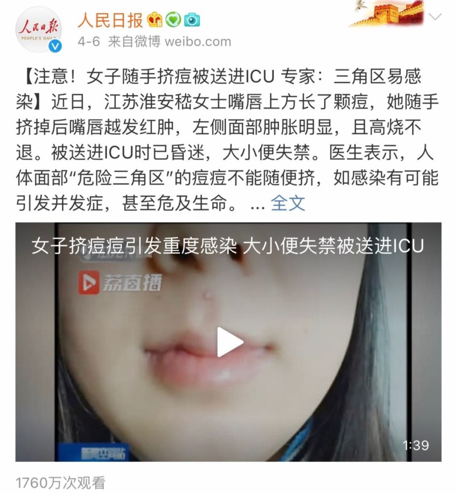 汨罗一市民挤痘痘后脸变形!面部"危险三角区"别乱动