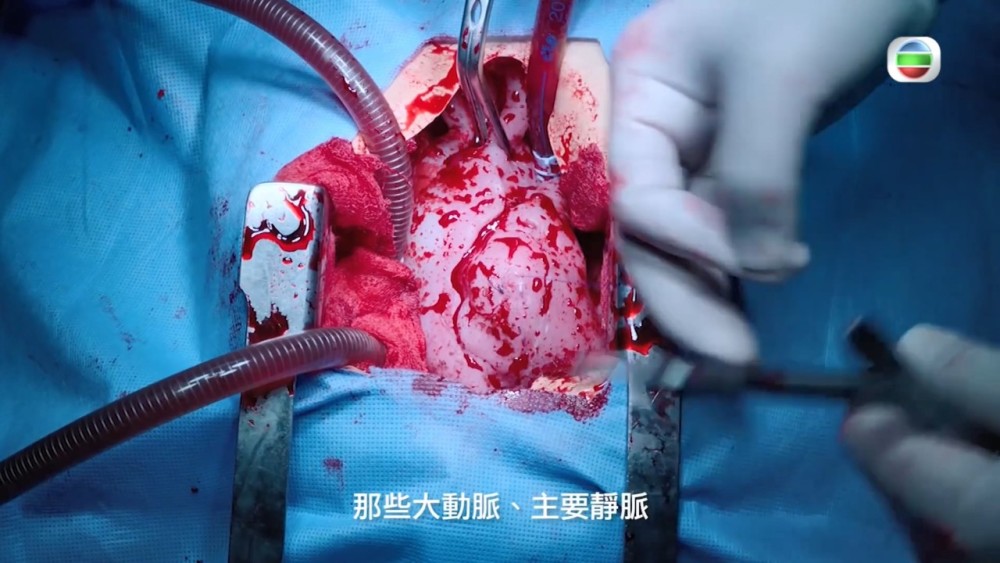 《白色强人》手术幕后大剖析,片中人脑心脏现实中到底
