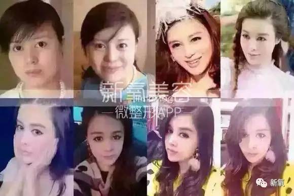 16萬的瘦臉、24萬的雙眼皮，天價(jià)整形背后的秘密！