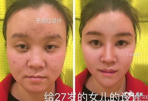 16萬的瘦臉、24萬的雙眼皮，天價(jià)整形背后的秘密！