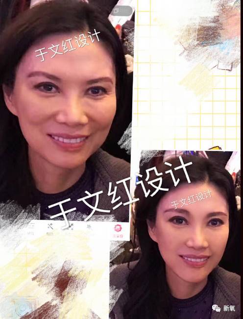 16萬的瘦臉、24萬的雙眼皮，天價(jià)整形背后的秘密！