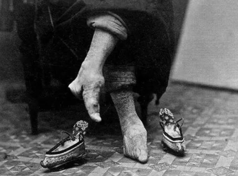 晚清妇女恐怖的畸形小脚,古代女子以"三寸金莲"做为审美标准,真的是太