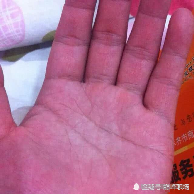 肝不好的人,手上会有6处异常,分别指什么?