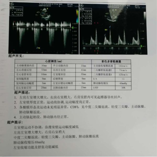 患者疾病进展后复查心脏超声结果 逐步滴定方案: 表2:arni滴定