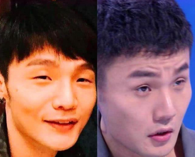 单眼皮男星变双眼皮:周杰伦帅气,李荣浩睁开眼,图5求你就这样