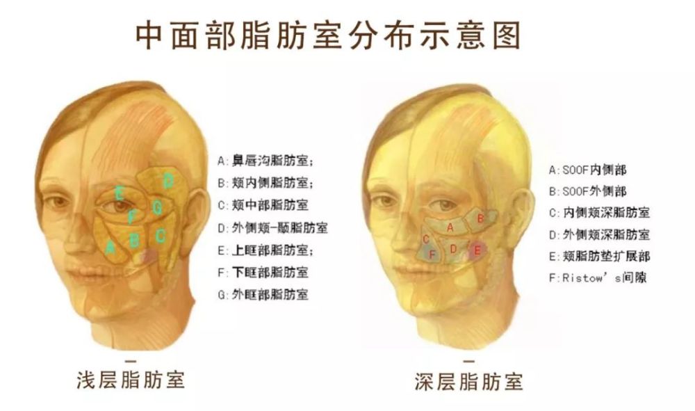 舒畅的脸也僵了,"脸僵"是不是脂肪填充后的必经阶段?