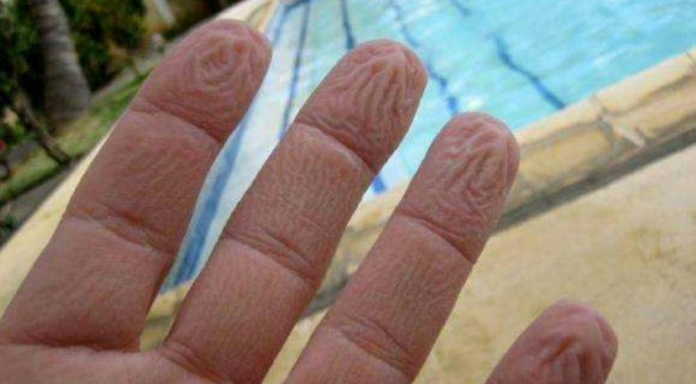 手指在水里面一泡久,就会出现变皱的现象,究竟是什么原因?