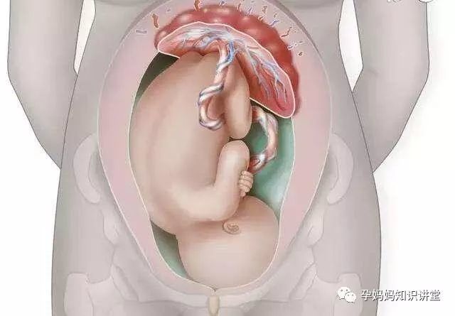 孕晚期,感觉宝宝总在右边胎动是怎么回事?孕妇须知这3