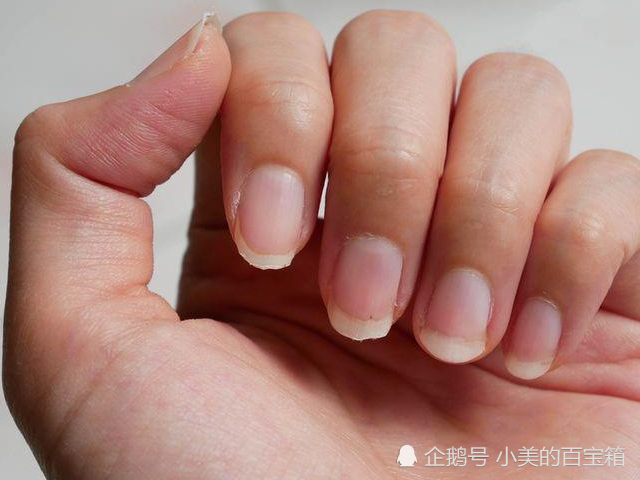 肝癌早期不痛不痒,一旦指甲鼻子出现这个信号,癌症离你就不远了