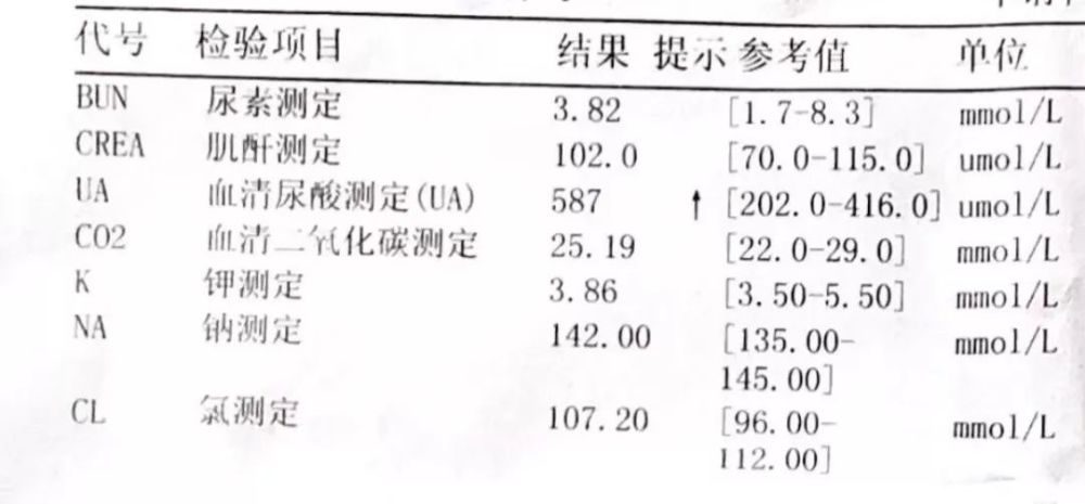 惠州一男子不到30岁就痛风!怀疑人生