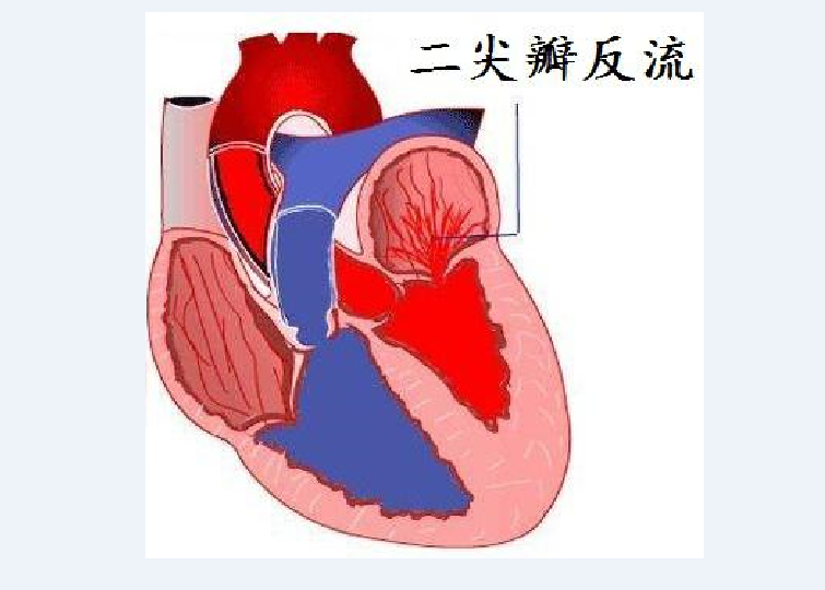 瓣膜,心脏