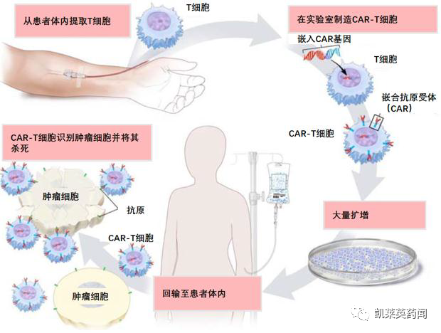 从合源生物纳基奥仑赛注射液获批窥见CAR T治疗的技术发展与市场 腾讯新闻