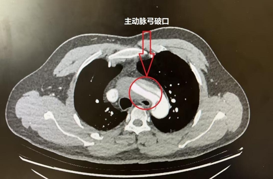 主动脉弓磁共振图像图片