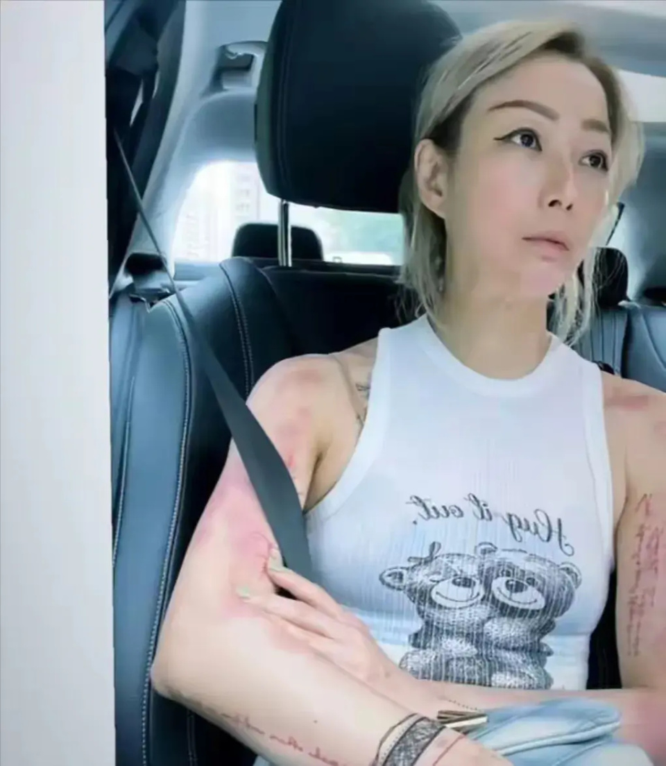 对许志安执迷不悔?瘦到脱相的郑秀文让女人清醒:爱情经不起考验